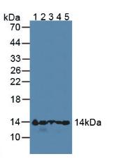 Polyclonal Antibody to Hemoglobin Alpha 1 (HBa1)