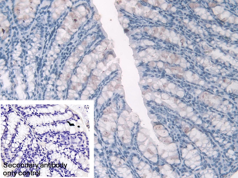 Polyclonal Antibody to Hemoglobin Alpha 1 (HBa1)