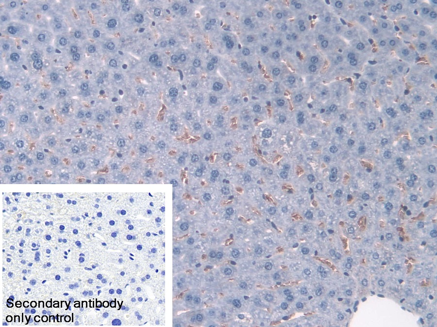 Polyclonal Antibody to Hemoglobin Alpha 1 (HBa1)