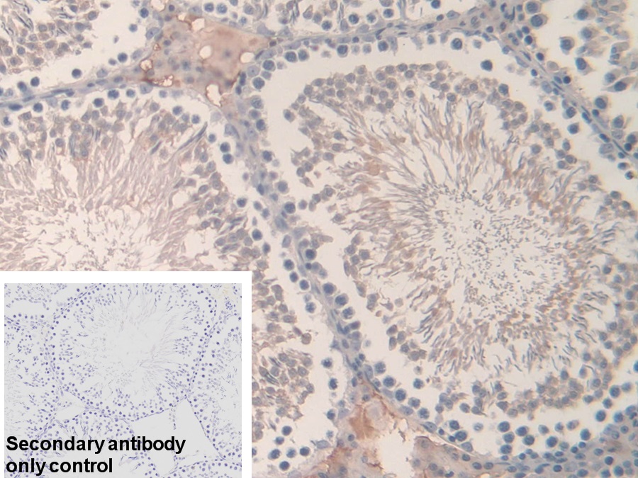 Polyclonal Antibody to Hemoglobin Alpha 1 (HBa1)