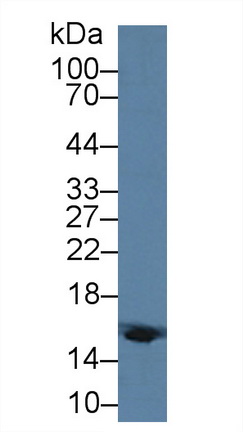 Polyclonal Antibody to Hemoglobin Delta (HBd)