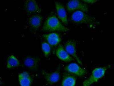 Polyclonal Antibody to Hemoglobin Delta (HBd)