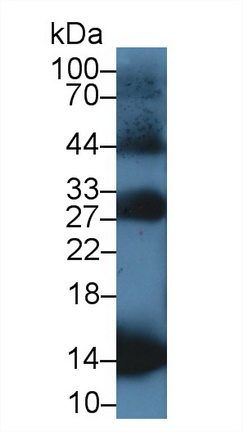 Polyclonal Antibody to Hemoglobin Beta (HBb)