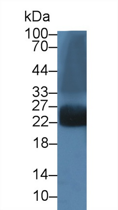 Polyclonal Antibody to Hemoglobin Beta (HBb)