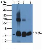 Polyclonal Antibody to Hemoglobin Beta (HBb)