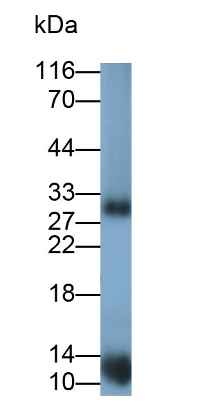 Polyclonal Antibody to Hemoglobin Beta (HBb)