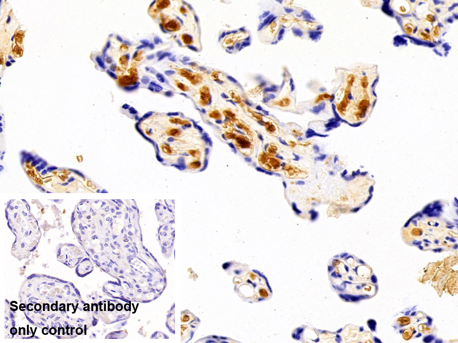 Polyclonal Antibody to Hemoglobin Beta (HBb)