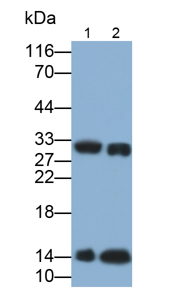 Polyclonal Antibody to Hemoglobin Beta (HBb)