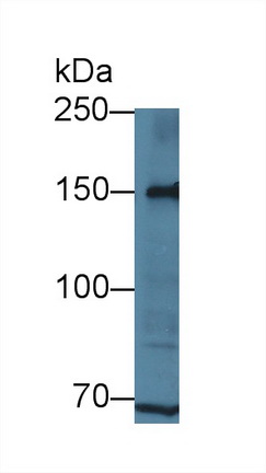 Polyclonal Antibody to Low Density Lipoprotein Receptor Related Protein 8 (LRP8)