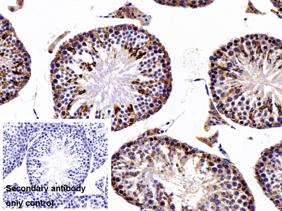 Polyclonal Antibody to Low Density Lipoprotein Receptor Related Protein Associated Protein 1 (LRPAP1)