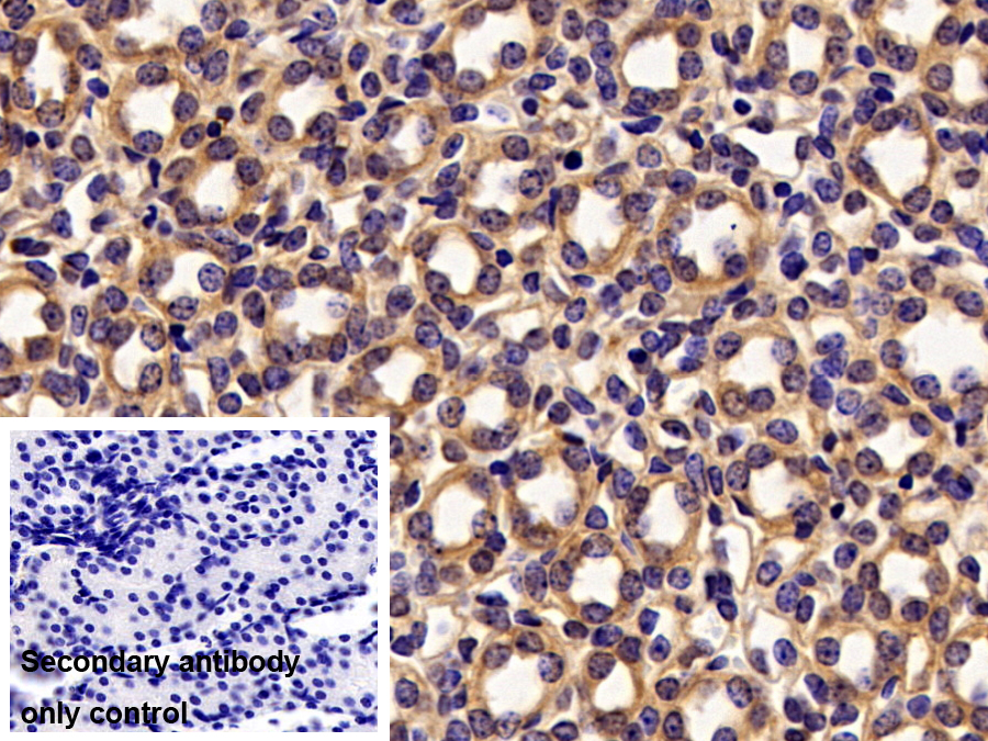 Polyclonal Antibody to Low Density Lipoprotein Receptor Related Protein Associated Protein 1 (LRPAP1)