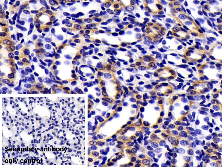 Polyclonal Antibody to Low Density Lipoprotein Receptor Related Protein Associated Protein 1 (LRPAP1)