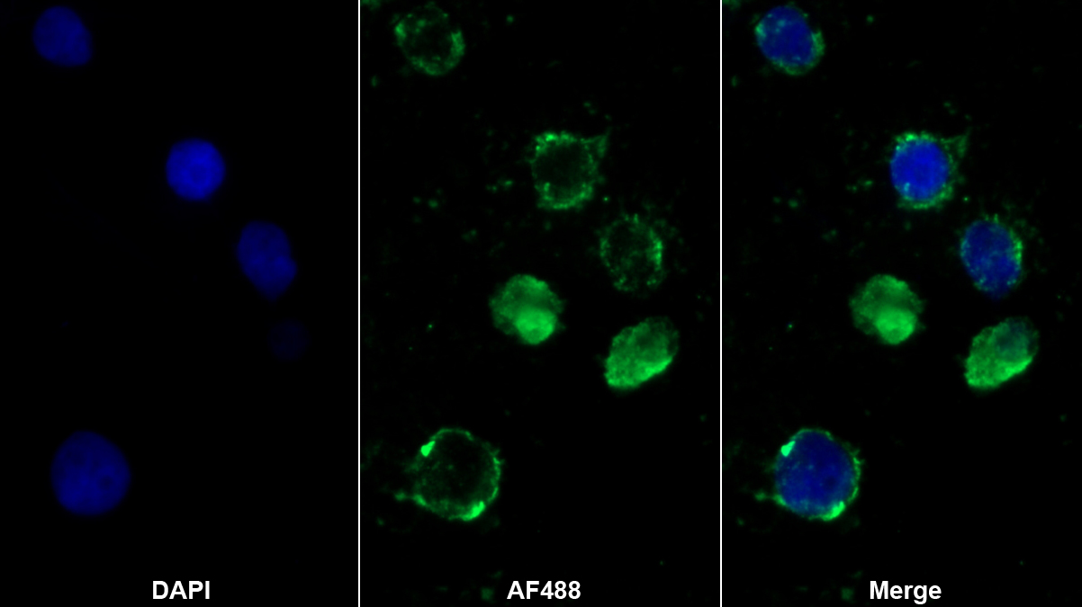 Polyclonal Antibody to Gastric Intrinsic Factor (GIF)