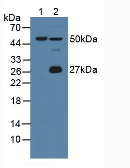 Polyclonal Antibody to Gastric Intrinsic Factor (GIF)