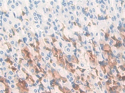 Polyclonal Antibody to Gastric Intrinsic Factor (GIF)