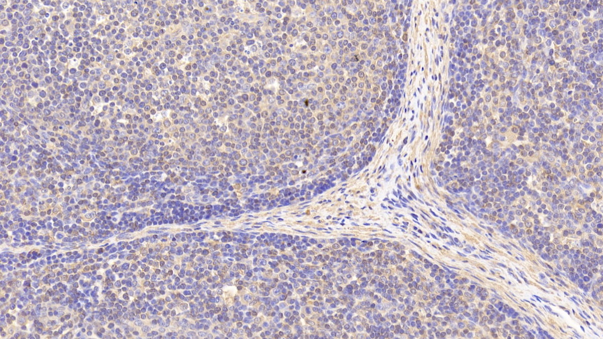 Polyclonal Antibody to Antigen Peptide Transporter 2 (TAP2)