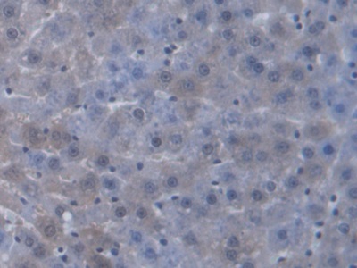 Polyclonal Antibody to Antigen Peptide Transporter 2 (TAP2)