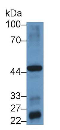 Polyclonal Antibody to Hedgehog Homolog, Indian (IHH)