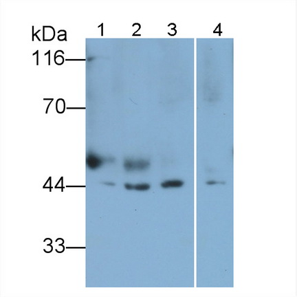 Polyclonal Antibody to Liver X Receptor Beta (LXRb)