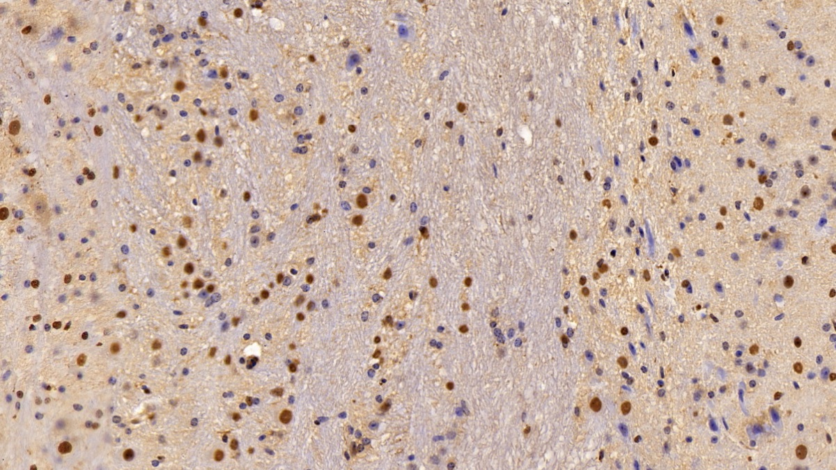 Polyclonal Antibody to Liver X Receptor Beta (LXRb)