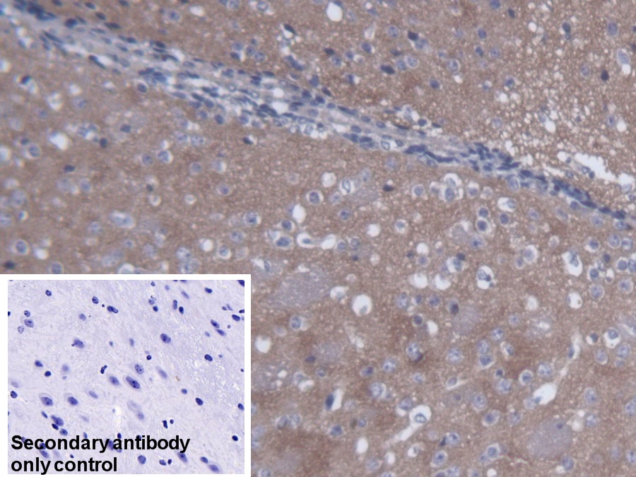 Polyclonal Antibody to Synapsin II (SYN2)