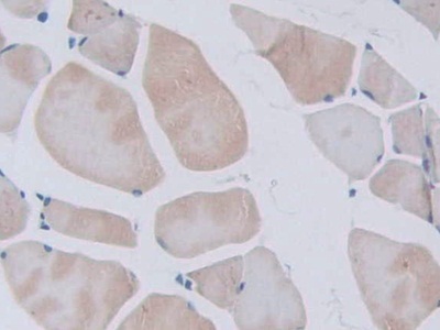 Polyclonal Antibody to Urocortin 3 (UCN3)