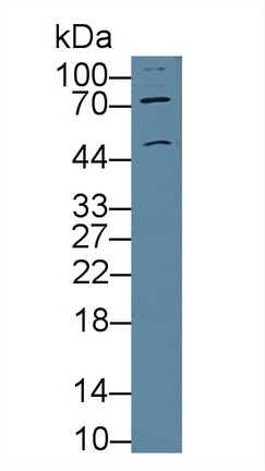 Polyclonal Antibody to Cholinergic Receptor, Nicotinic, Alpha 3 (CHRNa3)