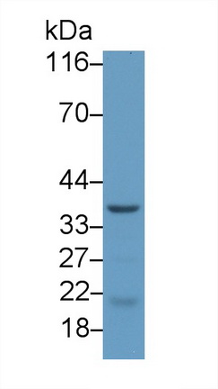 Polyclonal Antibody to Cholinergic Receptor, Nicotinic, Epsilon (CHRNe)