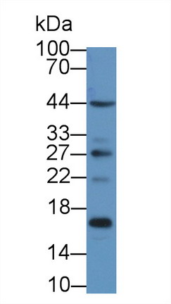 Polyclonal Antibody to S100 Calcium Binding Protein A16 (S100A16)