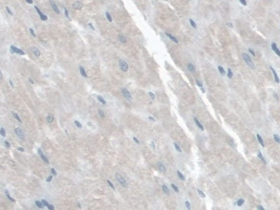 Polyclonal Antibody to S100 Calcium Binding Protein A16 (S100A16)