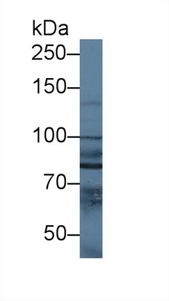 Polyclonal Antibody to N-Acetyl Alpha-D-Glucosaminidase (NAGLU)