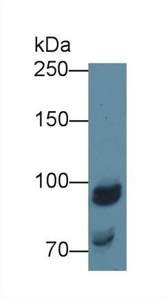 Polyclonal Antibody to N-Acetyl Alpha-D-Glucosaminidase (NAGLU)