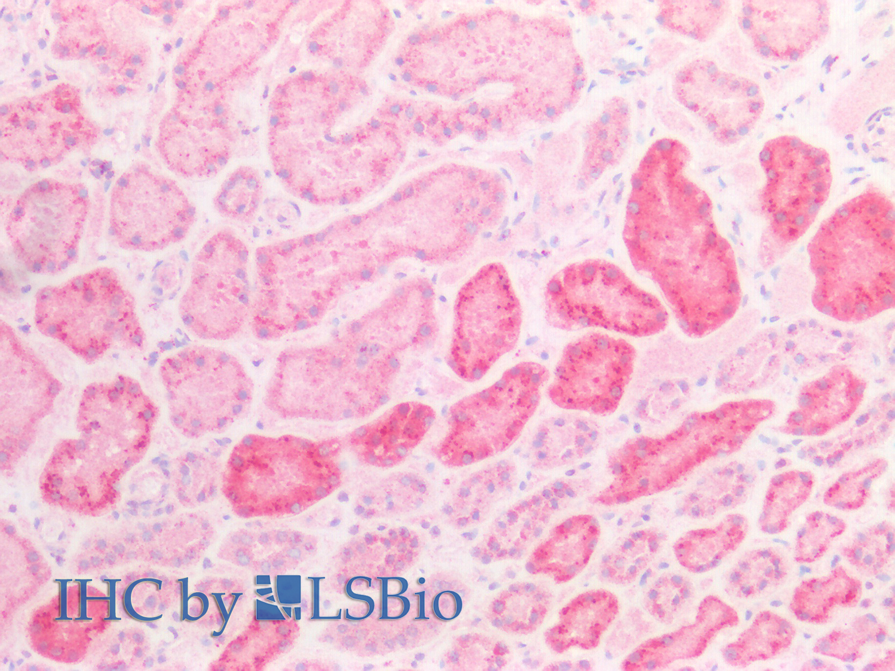 Polyclonal Antibody to N-Acetyl Alpha-D-Glucosaminidase (NAGLU)