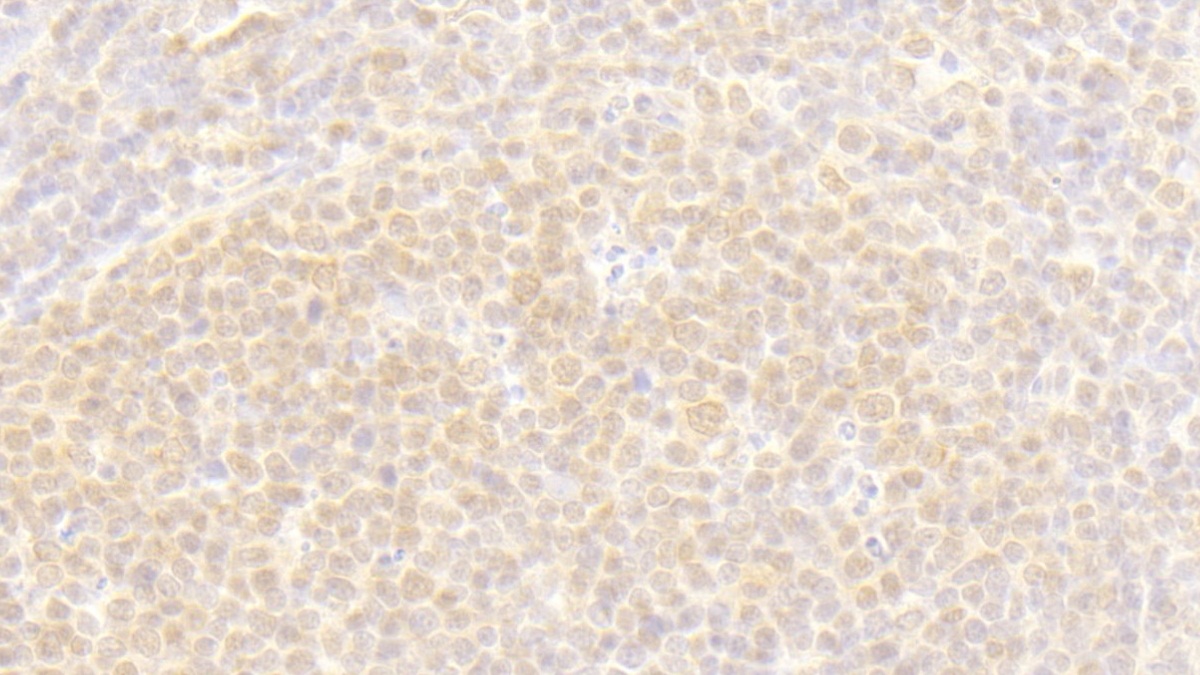 Polyclonal Antibody to Exoribonuclease 1 (ERI1)