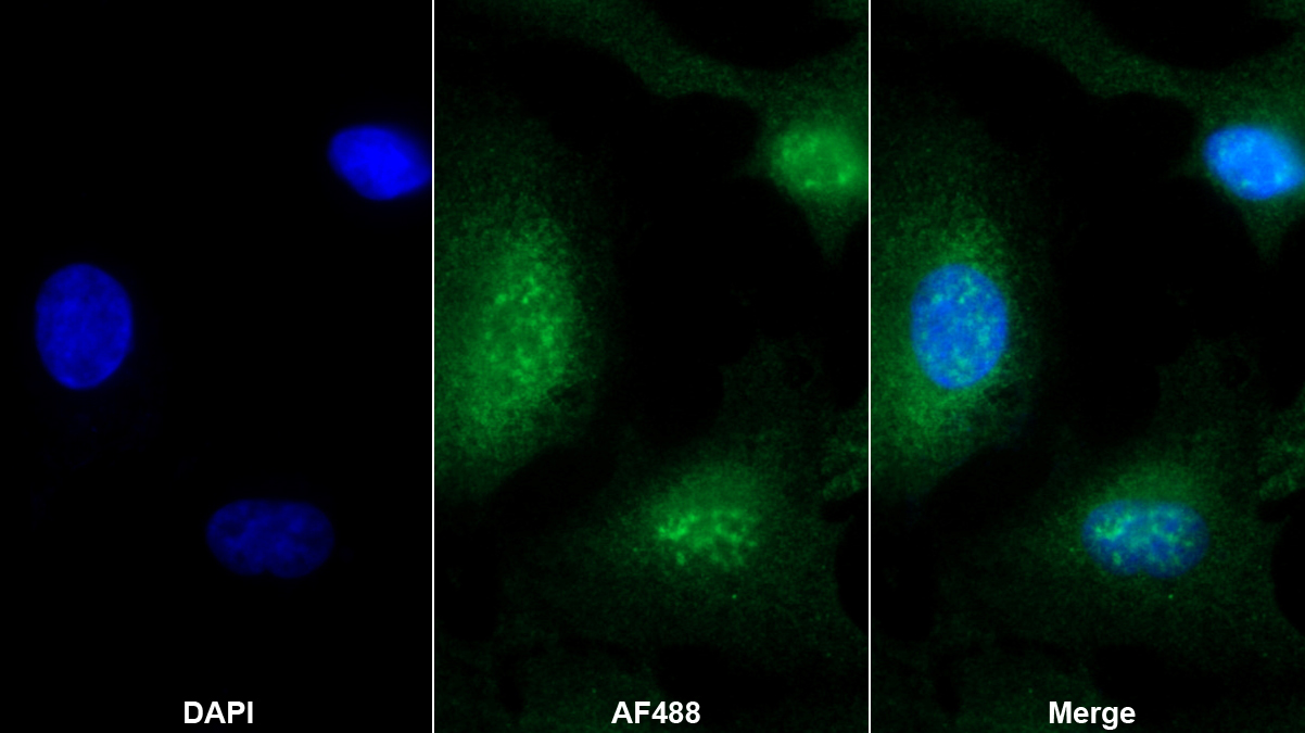 Polyclonal Antibody to Exoribonuclease 1 (ERI1)