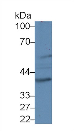 Polyclonal Antibody to Exoribonuclease 1 (ERI1)