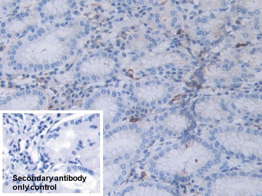 Polyclonal Antibody to Ribonuclease L (RNASEL)