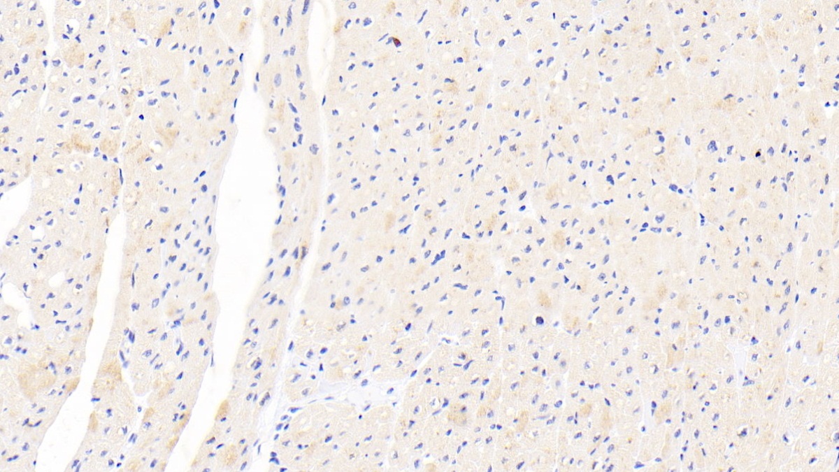 Polyclonal Antibody to 5'-3'Exoribonuclease 1 (XRN1)