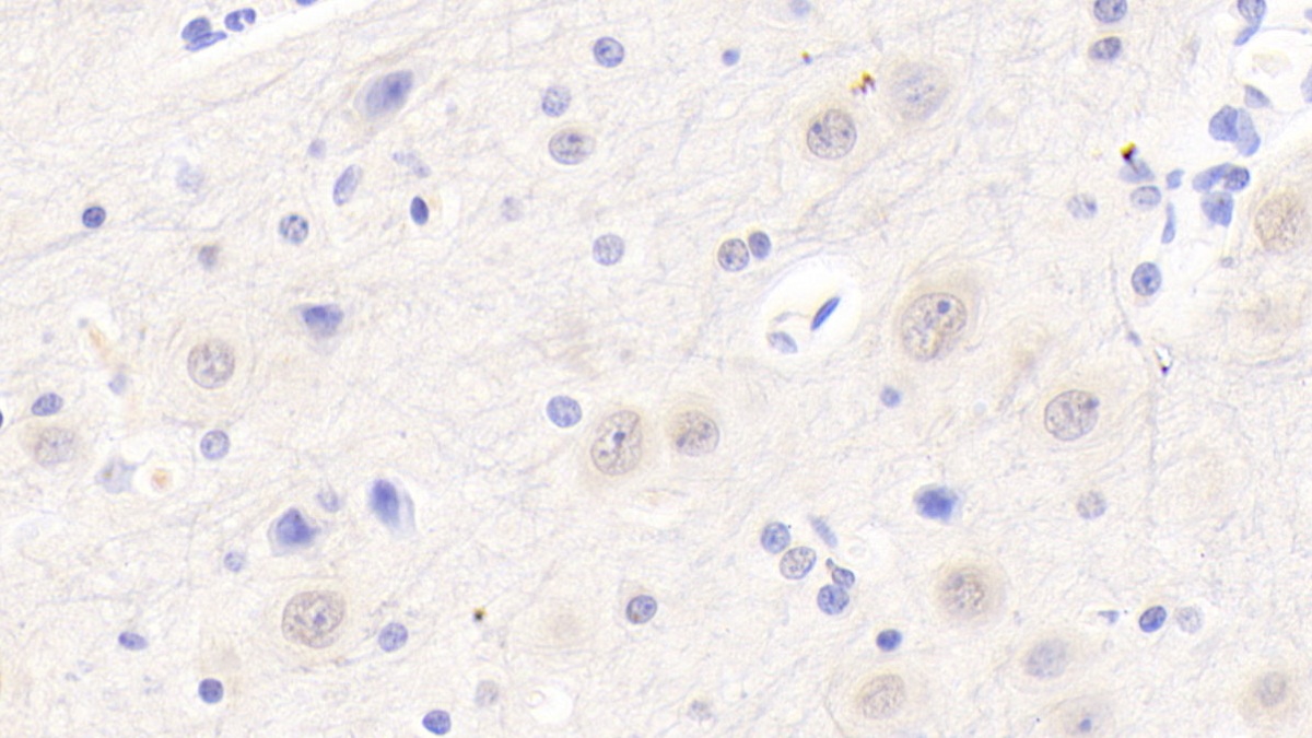 Polyclonal Antibody to 5'-3'Exoribonuclease 1 (XRN1)