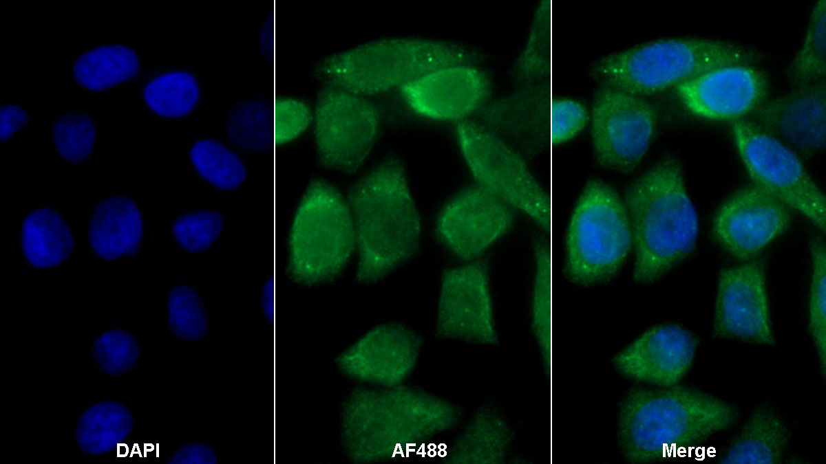 Polyclonal Antibody to 5'-3'Exoribonuclease 1 (XRN1)