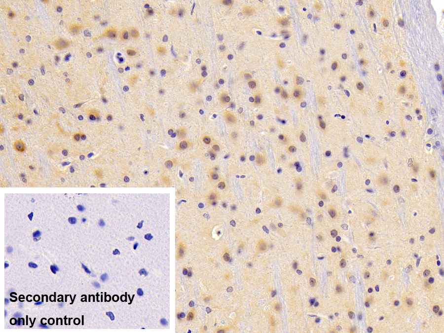 Polyclonal Antibody to 5'-3'Exoribonuclease 1 (XRN1)