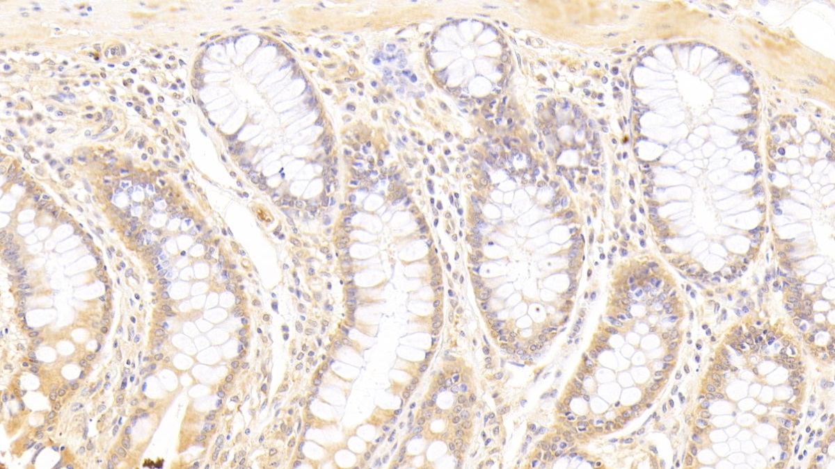 Polyclonal Antibody to Syntenin 2 (ST2)