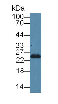 Polyclonal Antibody to Stromal Cell Derived Factor 2 Like Protein 1 (SDF2L1)