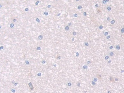 Polyclonal Antibody to Paraoxonase 2 (PON2)