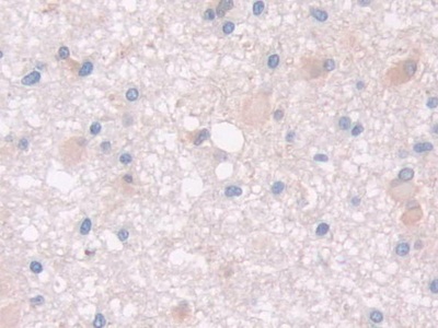 Polyclonal Antibody to Paraoxonase 2 (PON2)