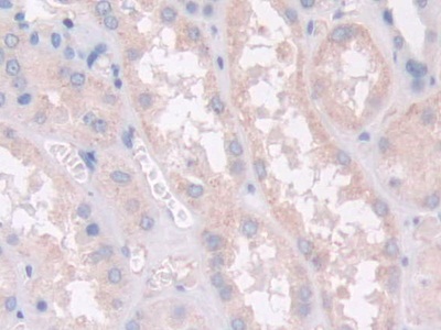 Polyclonal Antibody to Paraoxonase 2 (PON2)