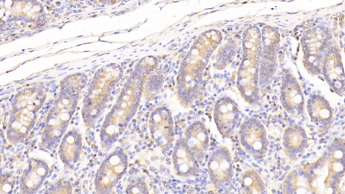 Polyclonal Antibody to Paraoxonase 2 (PON2)