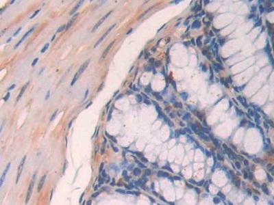 Polyclonal Antibody to Paraoxonase 2 (PON2)