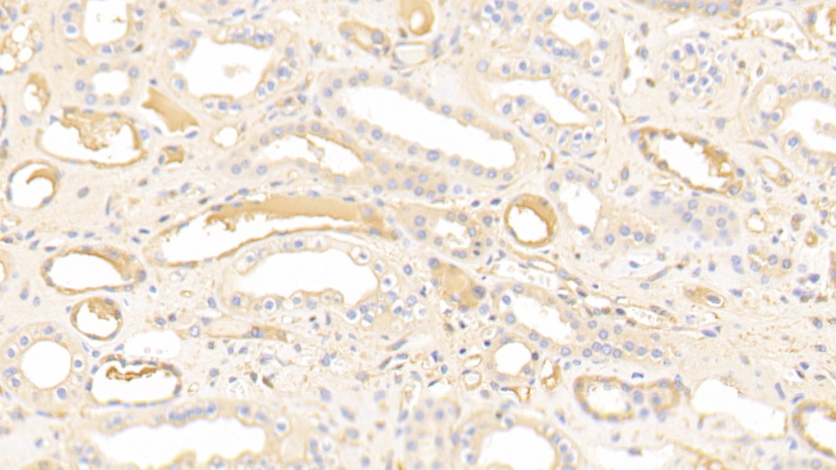 Polyclonal Antibody to Nucleobindin 1 (NUCB1)