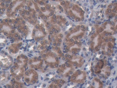 Polyclonal Antibody to Nucleobindin 1 (NUCB1)